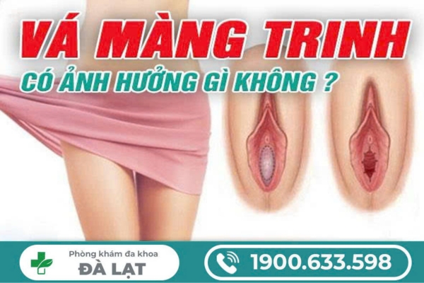 Hình ảnh minh họa